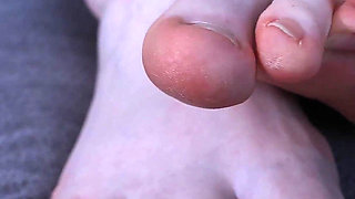 Ginger's Freezing Hurting Feet Nightmare