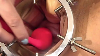 Cervix Vibration Play
